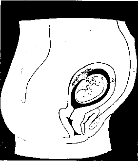 fetus 1 - Stumbling block: evolution, Adam and Eve, age of earth